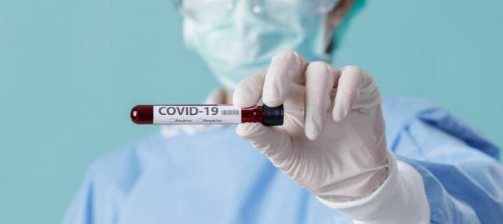 Informe de la Comisión Asesora COVID-19-OMC sobre pruebas diagnósticas